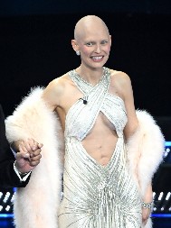 Supermodel Bianca Balti ponovo na sceni: Vodila Sanremo odmah nakon hemoterapije, "dijagnoza mi je izgledala kao smrtna presuda"