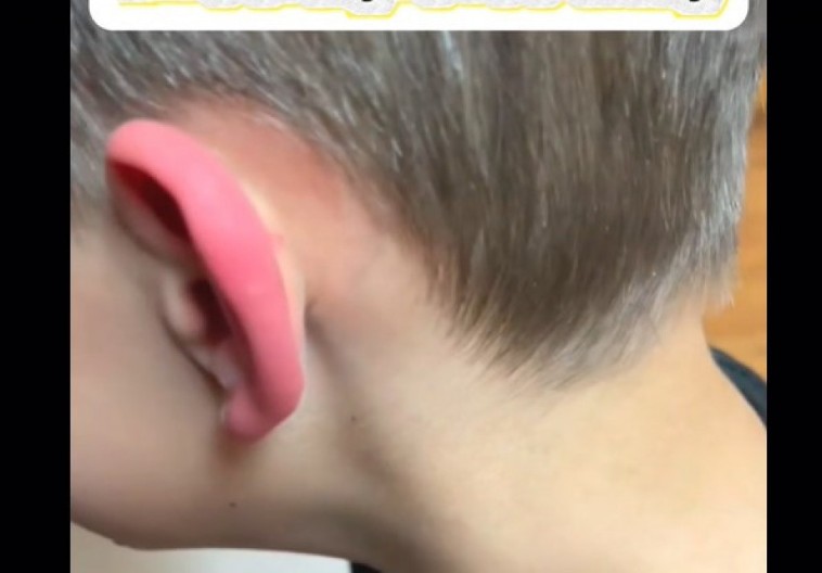 Dečak je jeo roštilj i dobio užasan bol u uhu: Analize kod lekara su pokazale uzrok koji ledi krv u žilama!