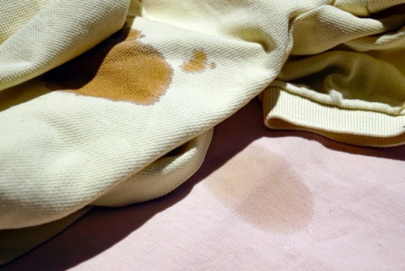 Skidaju sve masne fleke sa odeće: Uz samo 3 sastojka nestaće svi tragovi masnoće