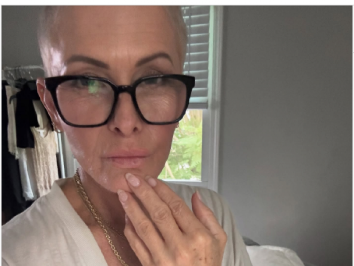 Zbog bolesti je sama obrijala svoju glavu: Sada se javno obratila svima - ovu poruku morate da pročitate