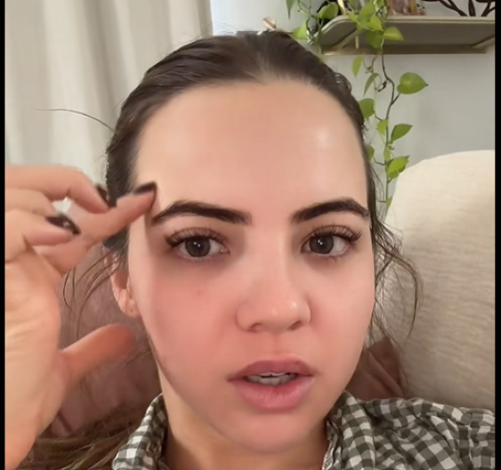 Strašne posledice botoksa: Devojka pokazala šta joj se desilo nakon tretmana - "paraliza lica nije ono najgore!"