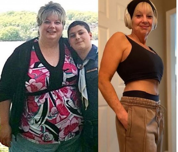 Istopila 80 kg bez operacije: Otkriva namirnice koje su joj pomogle da postigne neverovatnu transformaciju