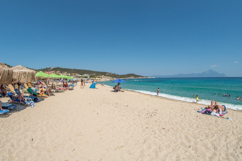 "Nemam pojma šta se desilo": Muškarac kroz smeh otkrio jezivu promenu na koži nakon letovanja — može biti opasno po život