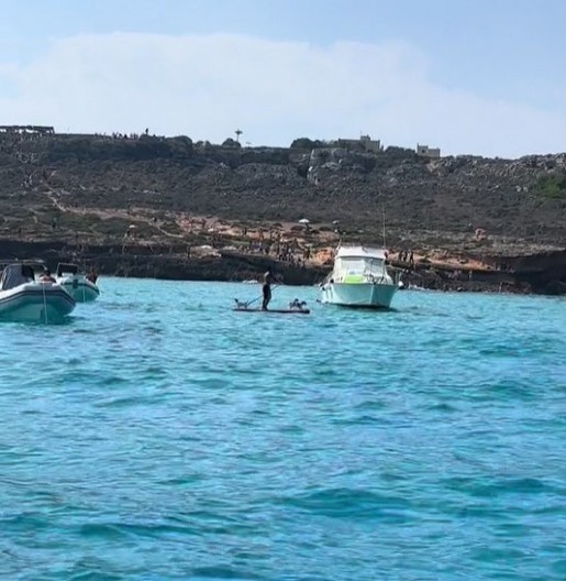 Evo za šta je sve dobra morska voda: Prirodni lek za psorijazu i iritacije kože