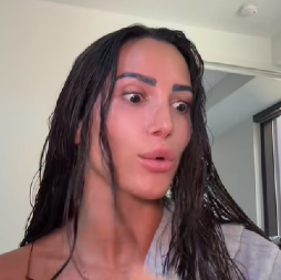 Da, da, sada ovako iscrtavaju usne: Dermatološkinja zgrožena novim trendom - ovo još nije videla u svojoj karijeri!