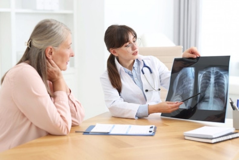 Nije samo kašalj - i ovo može biti rani simptom raka pluća: Ako primetite 1 specifičnu promenu, odmah se javite lekaru